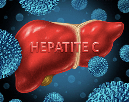 Doenças virais: Hepatite C