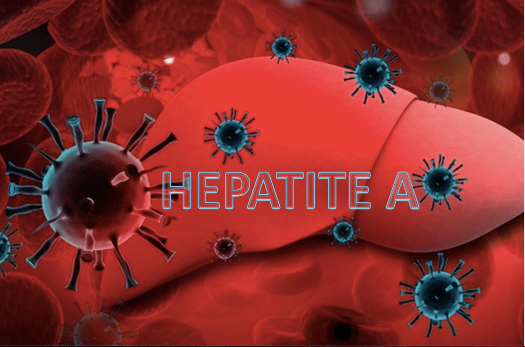 Doenças virais: Hepatite A