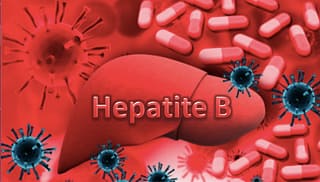 Doenças virais: Hepatite B