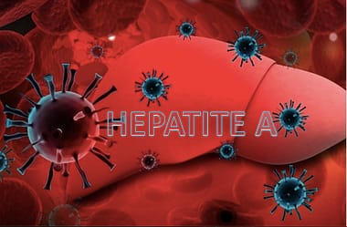 Doenças virais: Hepatite A