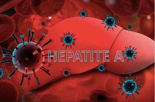 Doenças virais: Hepatite A