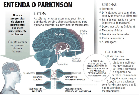 Ooforectomia bilateral e aumento do risco da doença de Parkinson